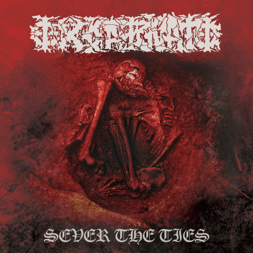 Sever the Ties